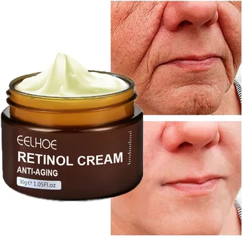 Retinol Anti Wrinkle Cream Anti-vananemise Plekid Freckles Eemaldamise Tugevneda Trahvi Read Koor Kindel Naha Niisutav Valgendamine Näohooldus